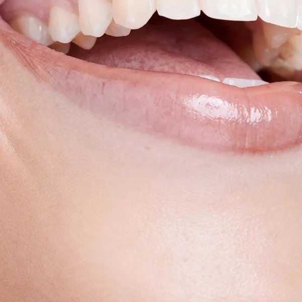 Illustrative draft image: Bright white smile after teeth whitening